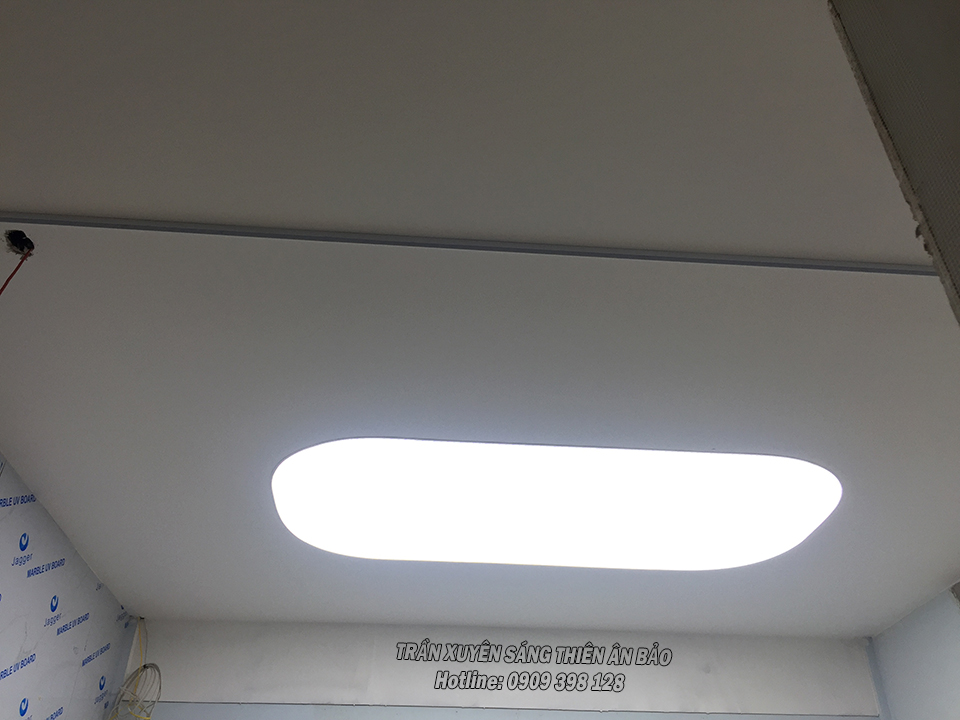 TRẦN XUYÊN SÁNG TRẮNG- NHA KHOA TÂM ĐỨC HÓC MÔN - Ảnh 4
